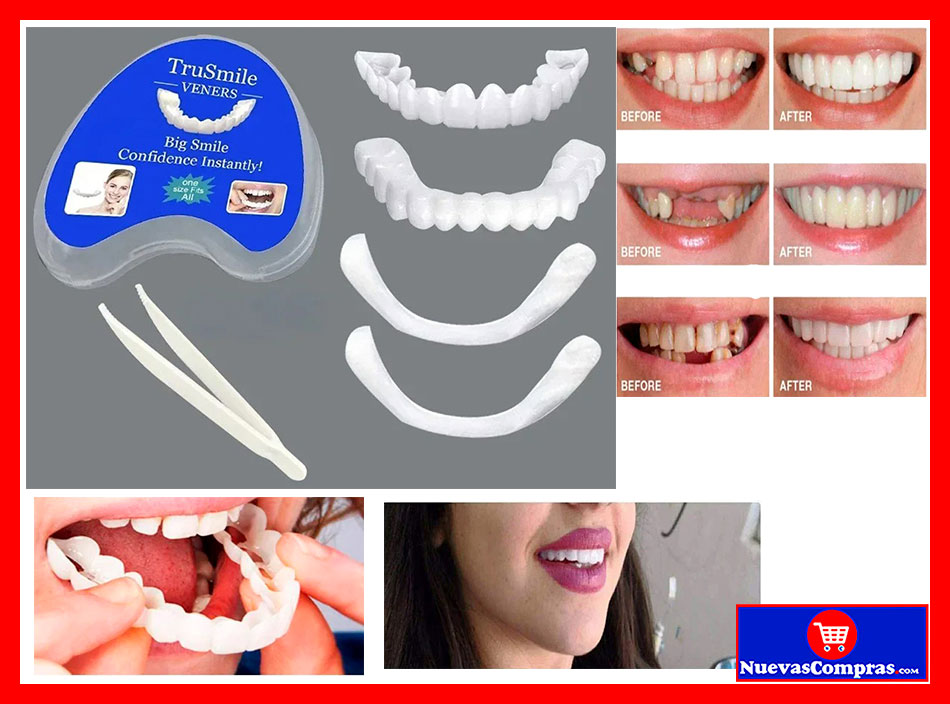 KIT DE DIENTES A PRESIÓN DE CHAPA – REEMPLAZO TEMPORAL DE BLANQUEAMIENTO DENTAL