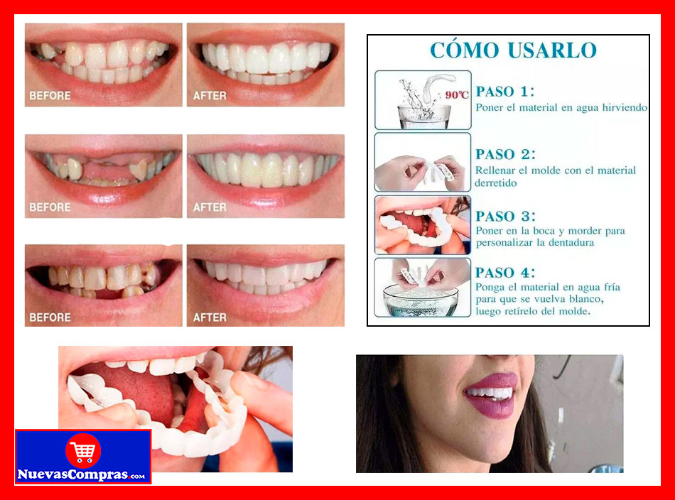 KIT DE DIENTES A PRESIÓN DE CHAPA – REEMPLAZO TEMPORAL DE BLANQUEAMIENTO DENTAL - Imagen 3